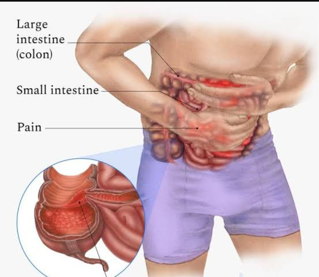 Ayurveda Gut Care