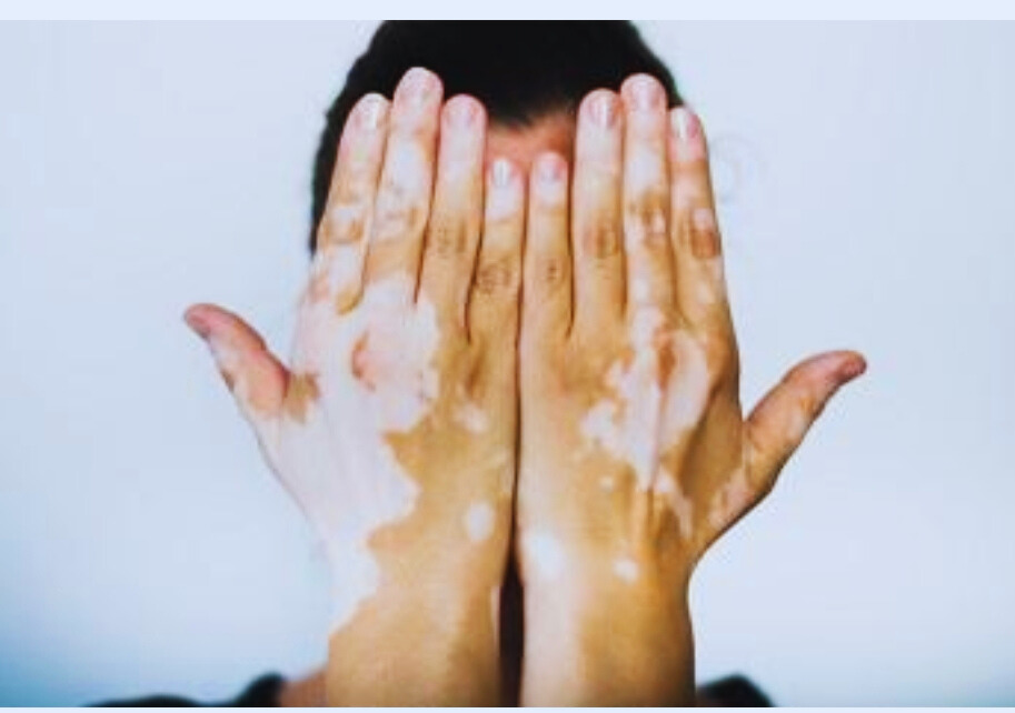 Ayurveda Skin Care